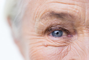 age-related macular degeneratioin
