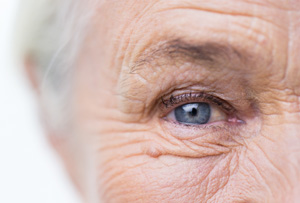 Age-Related Macular Degeneration and Nova Oculus Partners