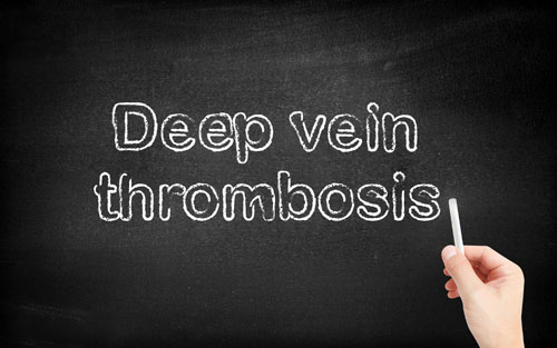 Are You at Risk for Deep Vein Thrombosis?
